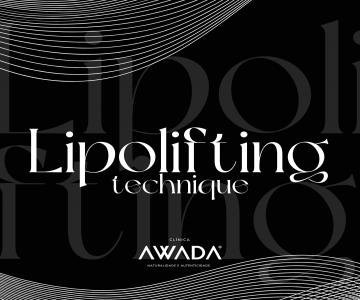 LipoLifting 