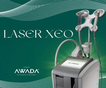 Laser Xeo