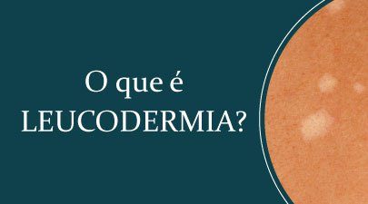 O que é LEUCODERMIA?